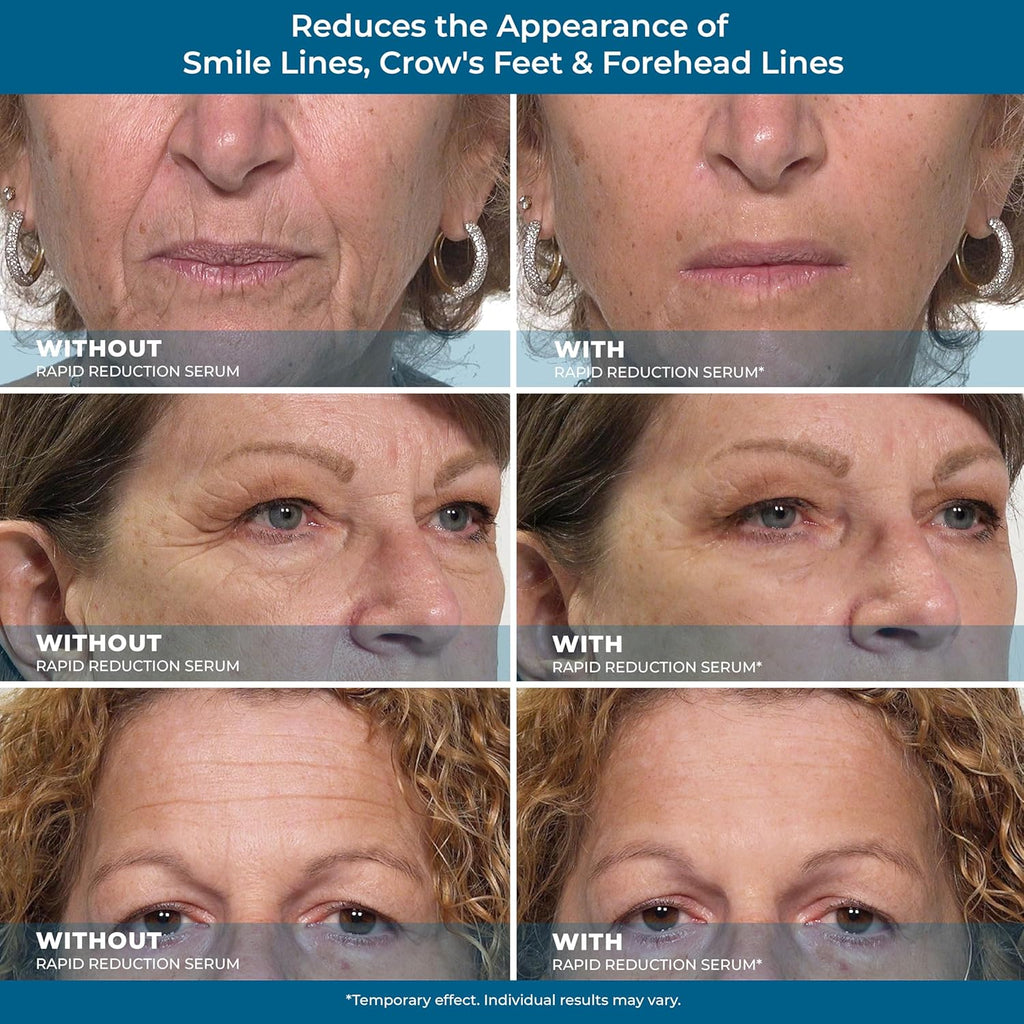 Rapid Reduction Eye Serum P96854